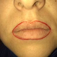 Подбор формы губ